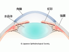 角膜周辺部の構造 （出典　日本眼科学会　目の病気）